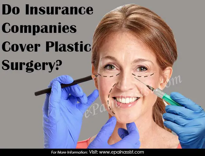 Do Insurance Companies Cover Plastic Surgery?
