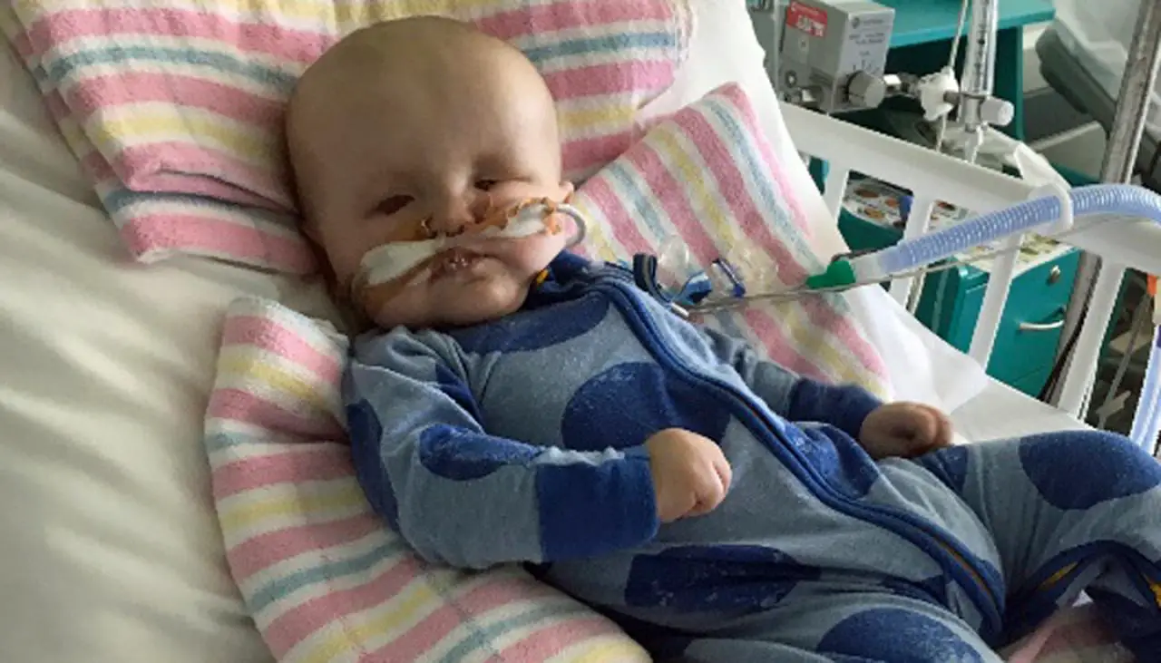 Family of baby born without eyes overwhelmed by donations ...