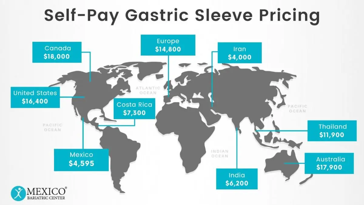 Gastric Sleeve Costs
