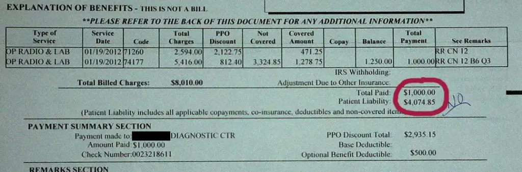 How much does a CT scan cost: $930 or $8,010? Or maybe ...