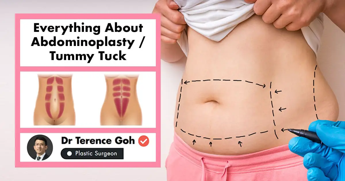 How To Get Insurance To Pay For Tummy Tuck ~ news word