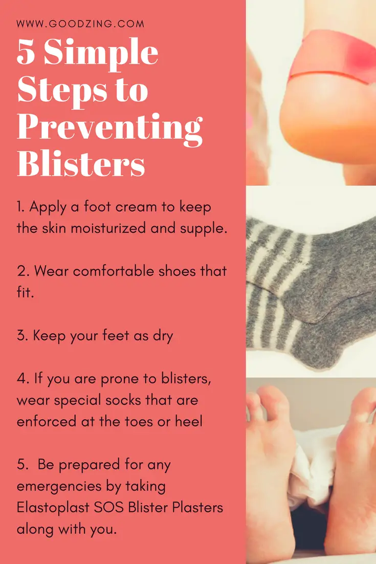 Ways to prevent blisters. Blister home remedies